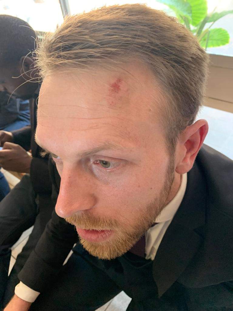 doug coltart assaulted by police